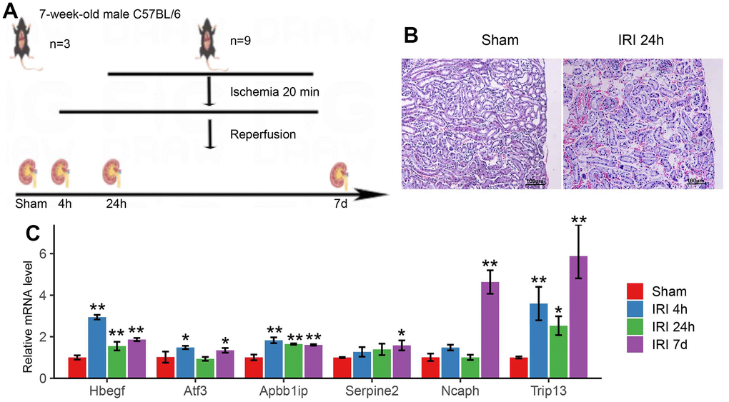 (A) The schematic graph of the mouse IRI model. (B) Pathological changes of renal tissue in 24h of IRI. (C) The qRT-PCR results of hub genes in the mouse IRI group and the normal group. * p