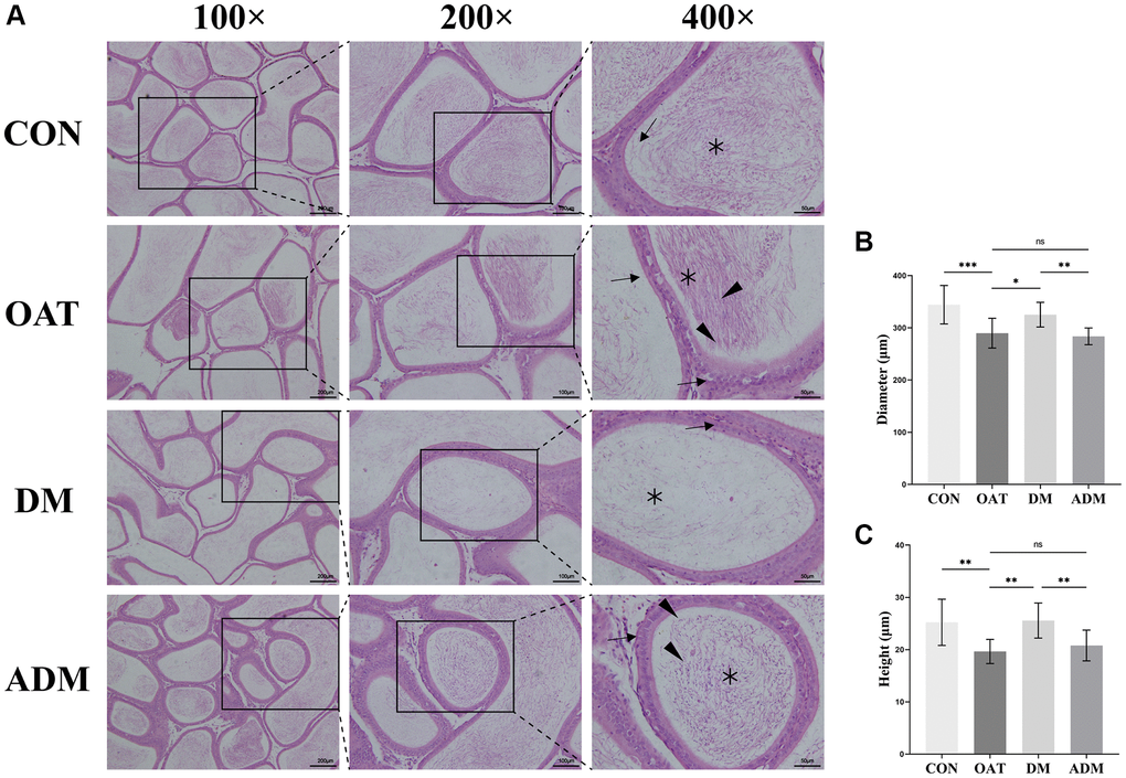 Moxibustion has a protective effect on preventing epididymal damage in rats with TGS-induced OAT. (A) Representative images of epididymal histology detected using H&E staining (×100; ×200; ×400). Black triangle: spermatogenic cells; black arrow: epididymal epithelium cells; black asterisk: spermatozoa. (B) Diameter of the epididymal duct; (C) Height of the epididymal epithelium. n = 10 in each group. *P **P ***P 