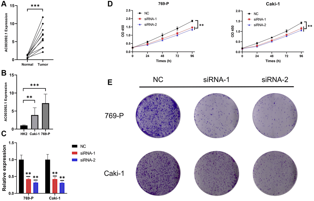 AC003092-knockdown suppressed proliferation in caki-1 and 769-P cells. (A) Differences in AC003092.1 expression between ccRCC tissues and adjacent tissues; (B) Differences in AC003092.1 expression between HK2 and renal cell lines 769-P and Caki-1; (C) The expression of AC003092 was downregulated in 769-P and Caki-1 cells, respectively, as determined by RT-qPCR; (D) AC003092-knockdown suppressed ccRCC cell proliferation in 769-P and Caki-1 cells; (E) Clonogenic formation in AC003092-knockdown 769-P and Caki-1 cells, along with images of formed clones following control cells for two weeks.