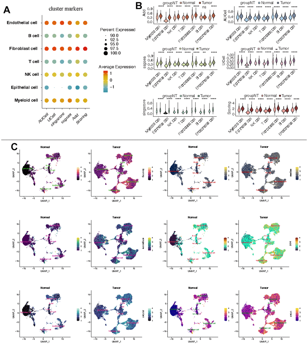 Estimation of CF state based on scRNA-Seq data. (A) CF state in each cell type; (B) Discrepancies of CF state in each cell type between KIRC and normal samples; (C) Detailed CF state depicted in a UMAP plot.