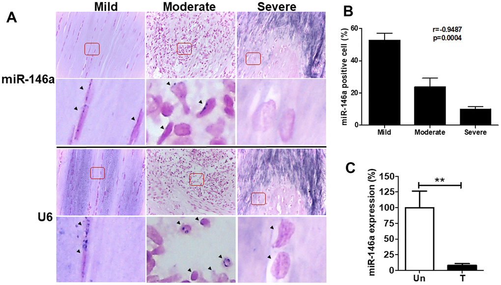 miR-146a expression in tendon tissues and tenocytes from rats with tendinopathy. Eight weeks after intratendinous injection of 10 μL collagenase I (0.015 mg/μL), the Achilles tendons were harvested from Sprague-Dawley rats. (A) Representative figures of in situ hybridization of miR-146a in rat tendinopathic tendons with different severity grades. Arrow heads indicate miR-146a- and U6-positive cells. Scale bars represent 50 μm in × 400 magnifications. The higher-magnification views of the red-boxed areas are shown beneath them. (B) miR-146a-positive cells were counted and normalized with U6-counterstained total cells (n=3). Spearman correlation rank test was used. (C) miR-146a expression levels in rat tendinopathic tenocytes primarily cultured from Achilles tendons treated (T) with collagenase I (0.015 mg/μL, 10 μL injection/rat) for 1 week or untreated (Un), as determined by qRT-PCR (n=3 for Un, n=5 for T). Values are represented as the mean ± SEM. **p