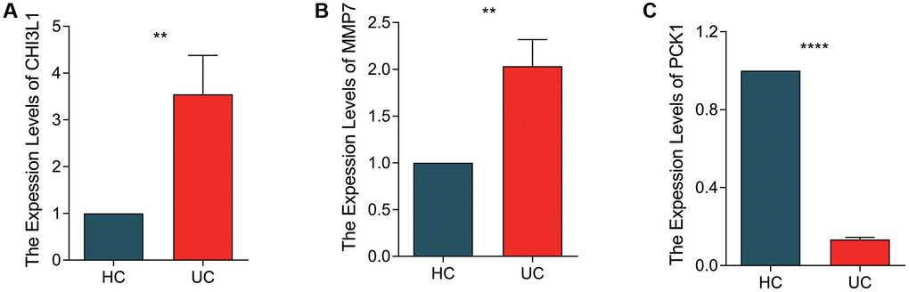 qRT-PCR validation of BRGs related biomarkers in NCM460 cell line and LPS-induced NCM460 cell line. The quantitative statistical analysis of expression levels of (A) CHI3L1, (B) MMP7 and (C) PCK1 in NCM460 and LPS-induced NVM460 cell lines. *p **p ***p 