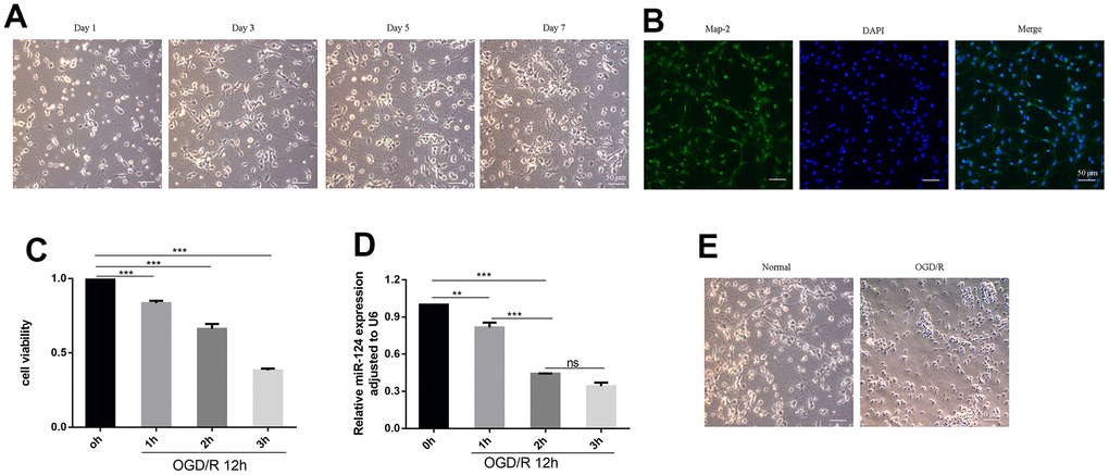 Expression of miR-124 and cell viability in OGD/R-induced neurons. (A) The change of primary neurons cultured up to day 1, day 3, day 5, and day 7; (B) Representative immunofluorescence images of Map-2 (green) and DAPI (blue) co-staining the primary cortical neurons. Scale bar, 50μm; (C) The Cell viability of the primary cortical neurons under OGD treatment for 0, 1, 2, and 3 h were detected by CCK-8 assay; (D) qRT-PCR analysis of miR-124 levels the primary cortical neurons under OGD treatment for 0, 1, 2, and 3 h; (E) the change between normal neurons and neurons after OGD(2h)/R treatment. Data were expressed as mean ± SD (derived from three independent experiments for each sample). NS, not significant for p > 0.05, * p p p 