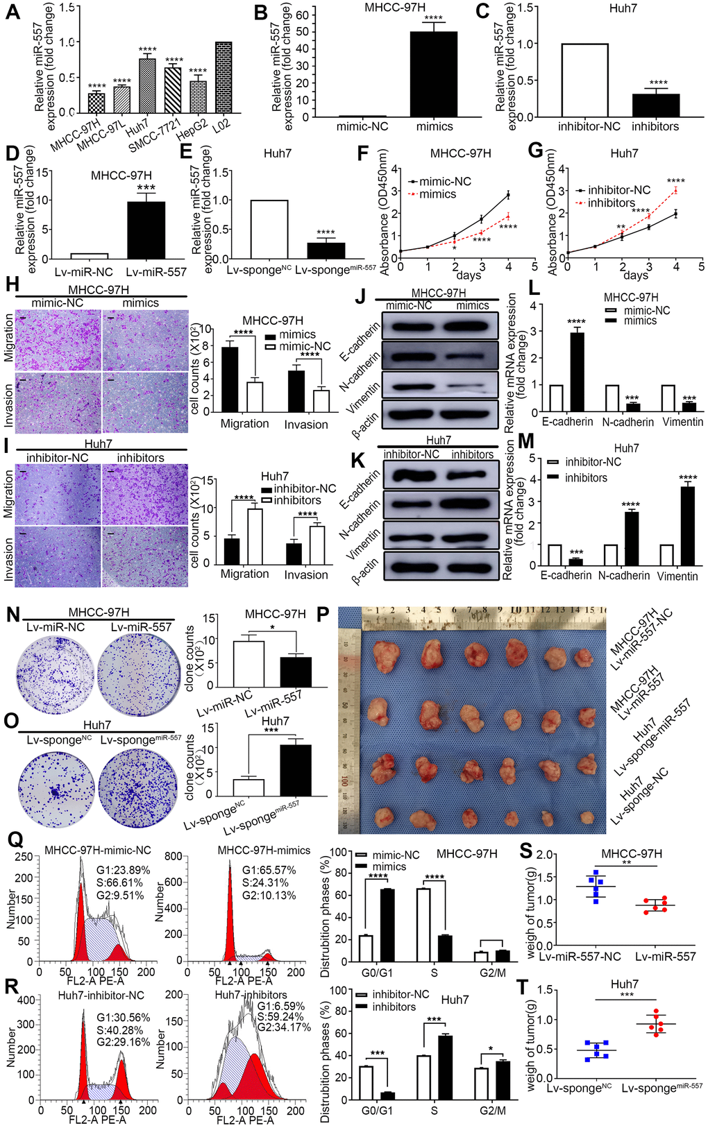 Effect of miR-557 on HCC cell proliferation, migration, invasion, cell cycle, and EMT. (A) Relative expression of miR-557 in different HCC cells lines. (B–E) Relative miR-557 expression in HCC cells that overexpressed miR-557, in MHCC-97H cells, and knockdown miR-557 in Huh7 cells. (F, G) CCK8 assays of mimic-NC cells and miR-557-overexpression cells of MHCC-97H, and CCK8 assays of inhibitor-NC cells and miR-557-inhibition cells of Huh7 cells. (H, I) Transwell assays of mimic-NC cells and miR-557-overexpression cells of MHCC-97H, and transwell assays of inhibitor-NC cells and miR-557-inhibition cells of Huh7 cells, Scale bar: 100 μm. (J–M) The protein and mRNA of EMT process of mimic-NC cells and miR-557-overexpression cells of MHCC-97H, and of inhibitor-NC cells and miR-557-inhibition cells of Huh7 cells. (N, O) Clone formation assay of Lv-miR-NC cells and Lv-miR-557-overexpression cells of MHCC-97H, and Clone formation assay of Lv-sponge-NC cells and Lv-sponge-miR-557-inhibition cells of Huh7 cells. (P) Orthotopic transplantation tumor formation with Lv-miR-NC and Lv-miR-557 overexpression in MHCC-97H cells or Lv-sponge-NC and Lv-sponge-miR-557-inhibition cells of Huh7 cells. (Q, R) The distribution phases of cell cycle of mimic-NC cells and miR-557-overexpression cells of MHCC-97H, and of inhibitor-NC cells and miR-557-inhibition cells of Huh7 cells. All blots were cut prior to hybridisation with antibodies during western blotting. (S, T) The tumor weight analysis of mimic-NC cells and miR-557-overexpression cells of MHCC-97H, and of inhibitor-NC cells and miR-557-inhibition cells of Huh7 cells. (*P 