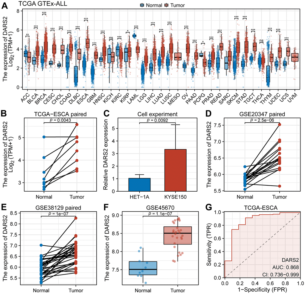 Bioinformatics analysis of DARS2 expression. (A) The expression level of DARS2 was assessed by analyzing the TCGA-GTEx pan-cancer datasets. (B) In the TCGA ESCA dataset, the differential expression of DARS2 between cancer samples and paired normal samples. (C) Cell experiments evaluated differences in DARS2 expression. (D–F) The variation in DARS2 expression was investigated between ESCA cancer tissue and normal tissue in the GSE20347, GSE38129, and GSE45670 datasets. (G) Receiver operating characteristic (ROC) curve analysis was conducted to evaluate the utility of DARS2 as a diagnostic marker for ESCA. *p 