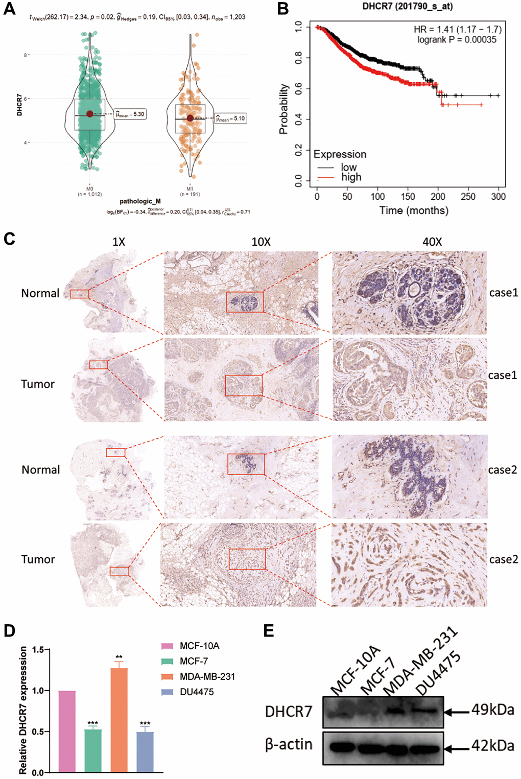Analysis of DHCR7 expression and survival in patients with BC. (A) Correlation analysis between DHCR7 expression and pathological M. (B) Higher DHCR7 expression induced poorer survival of BC patients. (C) IHC detected DHCR7 expression in BC tissues and adjacent normal tissues. (D, E) qRT-PCR and western blot examined DHCR7 expression in cell lines. **p ***p 