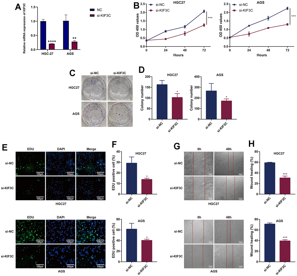 KIF3C knockdown suppresses the malignant phenotype of GC cells. (A) Knockdown efficiency of KIF3C in two Gastric cancer cell lines HGC-27 and AGS, including the, si-NC, and si-KIF3C groups. (B) CCK-8 assays were applied to detect the effect of KIF3C knockdown on the proliferation of HGC-27 and AGS cell lines. (C) Images of colony formation assay results after KIF3C knockdown in the HGC-27 and AGS cell lines. (D) Representative statistical analysis of the colony formation assay results. (E) DNA replication activity was assessed by an EdU-staining assay (green indicates the EdU-incorporated cells, blue indicates nuclei). GAPDH was used as an internal control. (F) Representative statistical analysis of the EdU assays results. (G) Wound-healing assays employed to detect the migration ability of KIF3C knockdown cells, including HGC-27 and AGS cells. (H) Representative statistical analysis of the wound-healing assays results. *p 