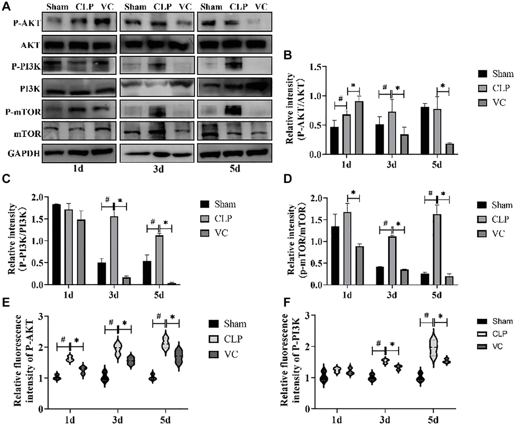 High-dose VC inhibited the PI3K/AKT/mTOR signaling pathway in CLP-Induced sepsis rats. (A–D) Representative images of the phosphorylation of PI3K, AKT and mTOR were examined by western blot and the fold activation data analysis. (E, F) The expression of the proteins p-Akt and p-PI3K was examined by immunofluorescence assay. Data are expressed as mean ± SD (at least n = 6/group), #p *p 