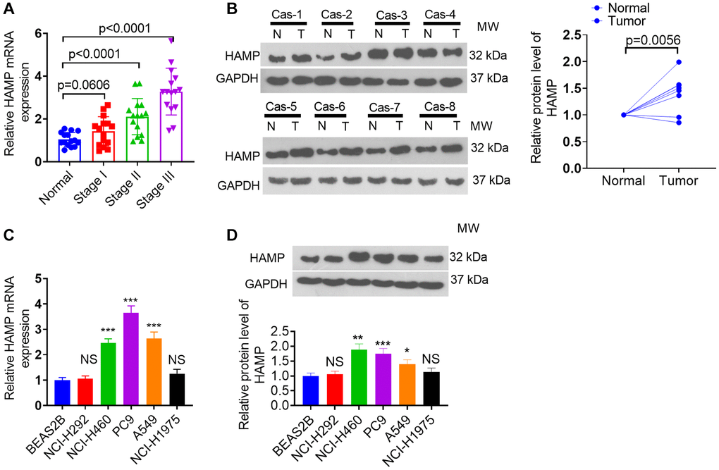 HAMP expression changes in NSCLC tissues and cells. (A, B) RT-PCR and western blot analyses were subsequently performed to assess HAMP mRNA expression in tumor tissues and adjacent normal tissues from individuals at distinct stages of NSCLC. (C, D) RT-PCR and western blot analyses of HAMP mRNA in NSCLC cells and normal cells. Abbreviation: NS: not significant. P > 0.05, *P **P ***P n = 3.