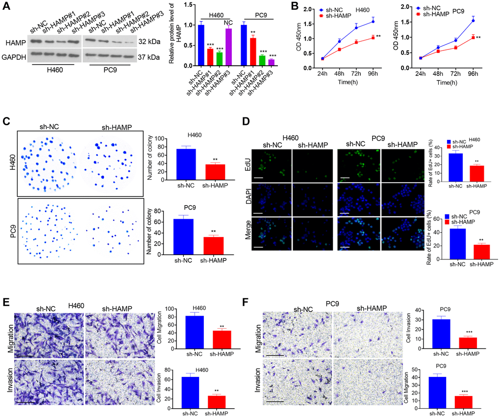 The effects of HAMP knockdown on the proliferation and invasion of NSCLC cells. (A) A cellular model for HAMP knockdown was established in H460 and PC9 cells, and western blot analysis was conducted to assess HAMP protein levels. (B) Cell proliferation was evaluated through a CCK-8 assay. (C) The ability of cells to form colonies was determined using a cell colony formation assay. (D) An EdU staining assay was used to evaluate cell proliferation. The scale bar is 50 μm. (E, F) Transwell assays revealed the migratory and invasive attributes of H460 and PC9 cells. Scale bar = 200 μm. NS P > 0.05, *P **P ***P n = 3.