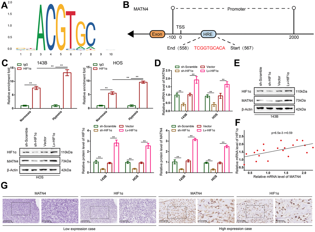 MATN4 was co-expressed with HIF-1α and regulated as a target gene of HIF-1α in OS cells and tissue. (A) Motif of HIF-1α. (B) Potential binding site of HIF-1α in the MATN4 promoter area. (C) CHIP and RT-qPCR assay were performed to verify that HIF-1α bound and up-regulated expression of MATN4 under hypoxia in vitro. (D, E) RT-qPCR and western blotting were performed to detect mRNA and protein expression of MATN4 in 143B and HOS cells transfected with sh-HIF1α or Lv-HIF1α under hypoxia. (F) Pearson correlation analysis was performed to demonstrate co-expression of HIF-1α and MATN4. (G) IHC assays were performed to show co-expression HIF-1α and MATN4 in vivo. *, p 